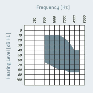 Hearing_Level